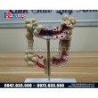 Mô hình các bệnh lý đại tràng hay gặp