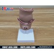 Mô hình hậu môn trực tràng bệnh lý